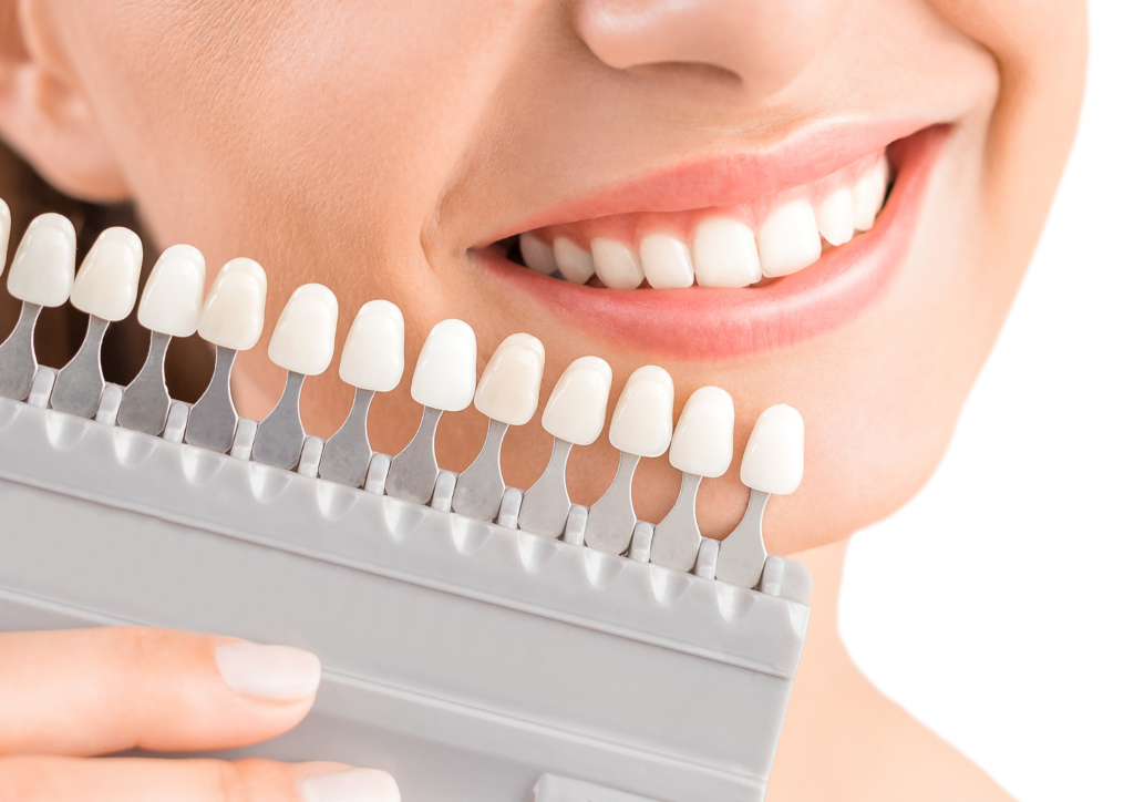 Clareamento dental na Vila Mariana